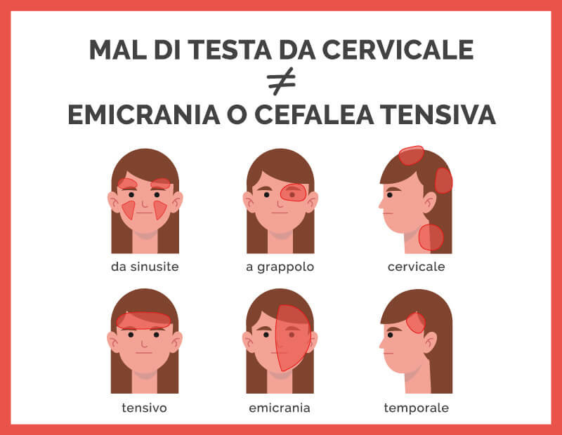 grafica mal di testa da cervicale diverso da emicrania o cefalea intensiva